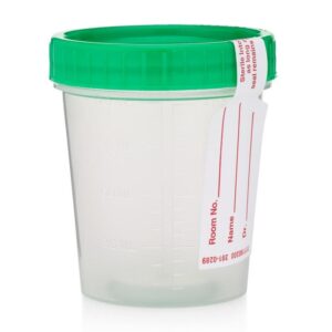 Screw Top Urine Specimen Container